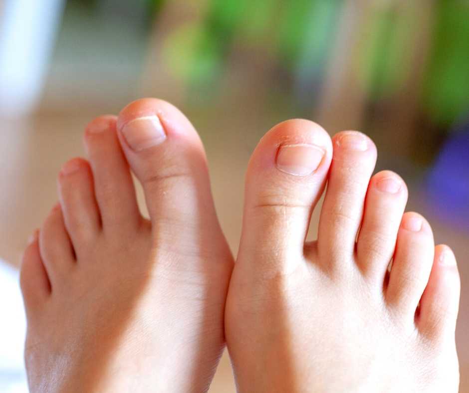 Ingrown-toenail